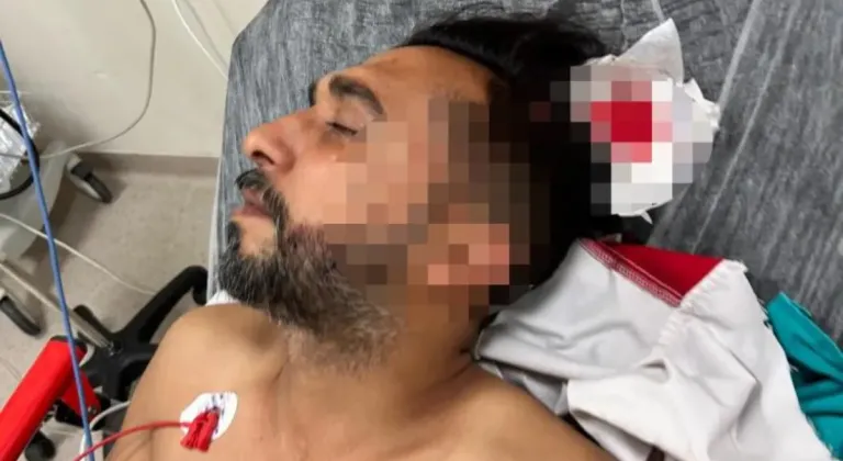 Döner ustası çalışırken başına yorgun mermi düştü