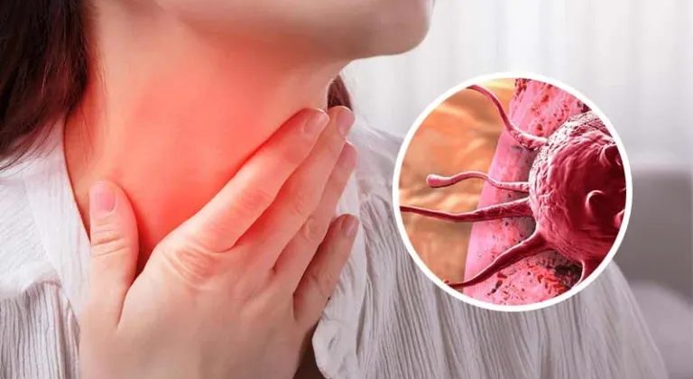 Lenfomada erken teşhis hayat kurtarır