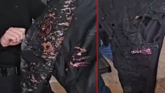 Ali Yerlikaya'dan polise asit atılmasına sert tepki!
