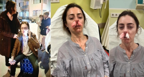 Yok artık! Kocasının sevgilisine benzettiği kadını darbetti, pardon deyip kaçtı