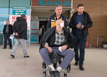 Boya tüpü patladı, gözünden yaralandı