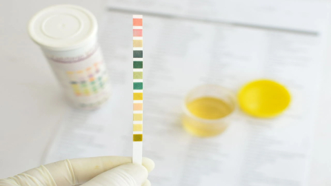 İdrar rengi ve miktarı böbrek sağlığına dair ipucu veriyor