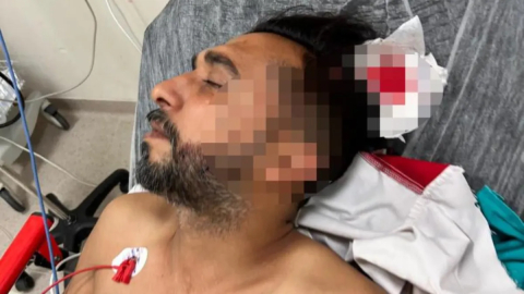 Döner ustası çalışırken başına yorgun mermi düştü