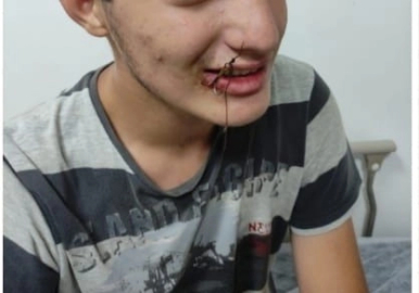 Bursa'da ilginç anlar: Bu kez oltaya çocuk takıldı