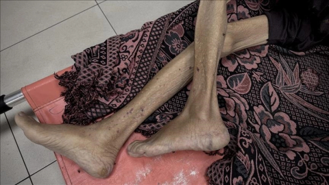 Gazze'de son 24 saatte 3'ü çocuk 10 kişi daha açlıktan hayatını kaybetti