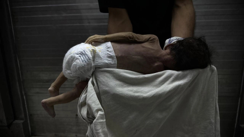 Gazze'de 13 kişi daha açlıktan hayatını kaybetti