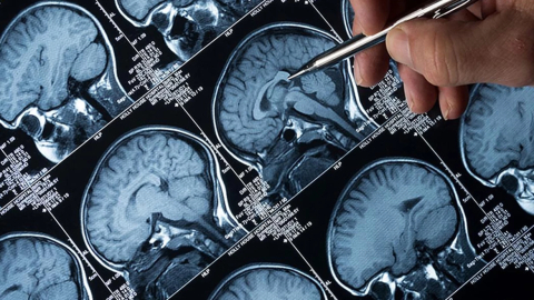 Ülke şokta: 'Beyin yiyen amip'ten 19 kişi öldü