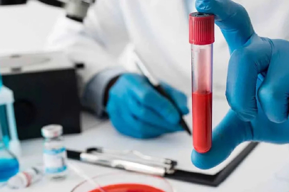 Kansızlığı anlamanın 7 sinyali: Bu belirtiler varsa dikkat