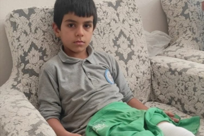 Bursa'da sahipsiz köpek çocuğa saldırdı