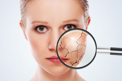 Cildiniz için kışa hazırlık reçetesi