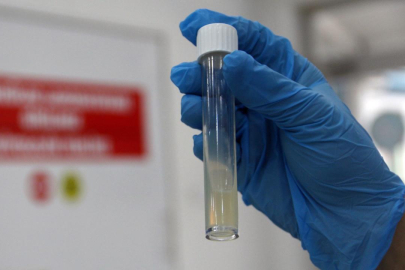 Dünyanın en ölümcül bulaşıcı hastalığı geçen yıl 1,23 milyon can aldı