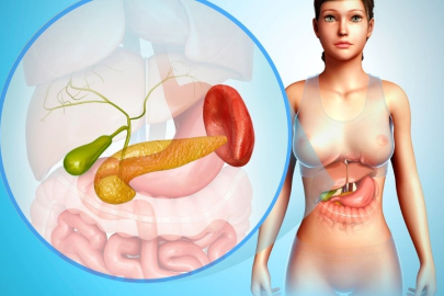 Sessiz katil: 'Pankreas Kanseri'