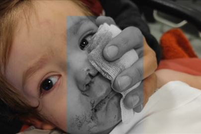 Başkentte 2 çocuğu yaralayan pitbull cinsi köpeğin sahibi gözaltına alındı