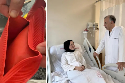 Sıcak su torbası patladı: Genç kızın vücudunun yüzde 25'i yandı