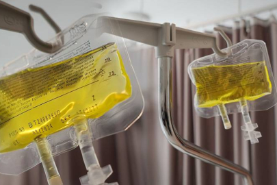 Uzmanlardan 'sarı serum' uyarısı! "Bir şey olmaz" demeyin