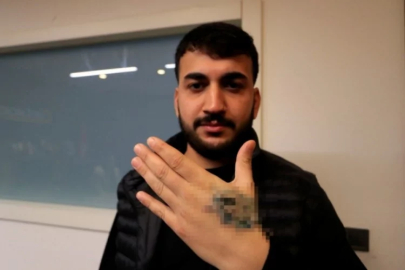 Dövme sildirmek istedi! Eli ölüyor...