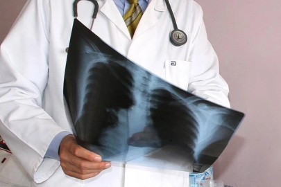 Soğuk havalarda zatürreye dikkat: Erken müdahale önemli