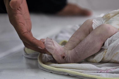 Gazze’de 27 günlük bebek soğuktan öldü