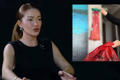 Danla Bilic’in dolgu kabusu bitmiyor: 6. kez ameliyat olacak!