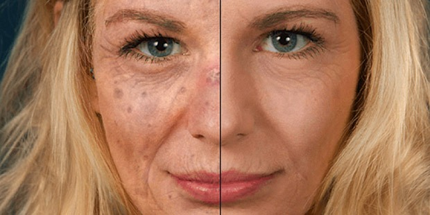 1. Güneş koruyucu kullanmamak