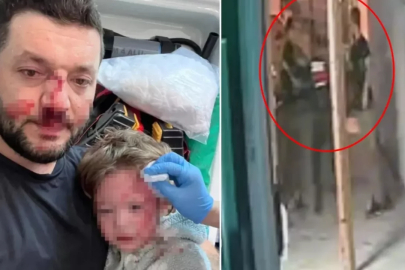 Yalova'da baba ile 14 aylık bebeğinin darbedildiği görüntüler ortaya çıktı!