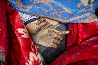 Katil İsrail'in Gazze'ye saldırılarında can kaybı 72 bin 280'e yükseldi