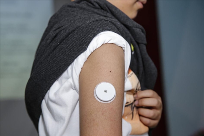 Bursa’da diyabetli öğrencilere sensör desteği