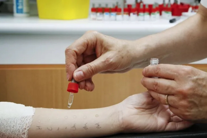 Bursa, bağışıklık bilimcileri ağırlayacak...