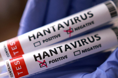 İngiltere: Bir İngiliz vatandaşında daha hantavirüs şüphesi tespit edildi