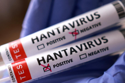 AB, hantavirüse karşı aşı ve tedavi yöntemleri geliştiriyor